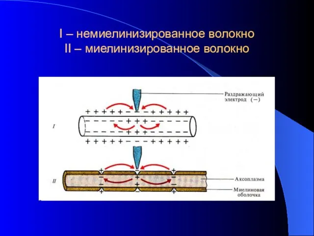 I – немиелинизированное волокно II – миелинизированное волокно