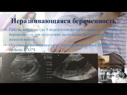 Гибель эмбриона (до 9 недель) или плода на сроке до 22
