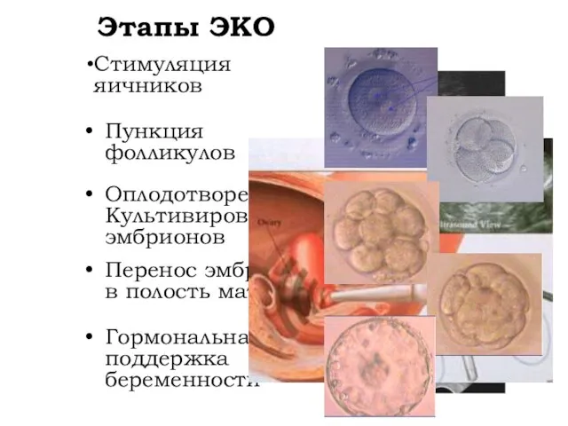 Этапы ЭКО Стимуляция яичников Пункция фолликулов Оплодотворение. Культивирование эмбрионов Перенос эмбрионов