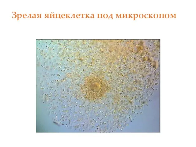 Зрелая яйцеклетка под микроскопом