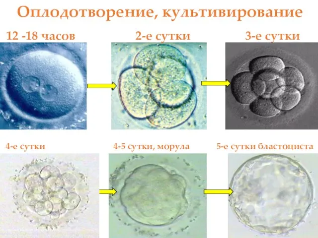 Оплодотворение, культивирование 2-е сутки 3-е сутки 4-е сутки 4-5 сутки, морула