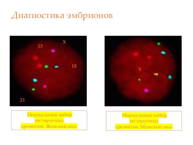 Диагностика эмбрионов Нормальный набор тестируемых хромосом. Женский пол. Нормальный набор тестируемых