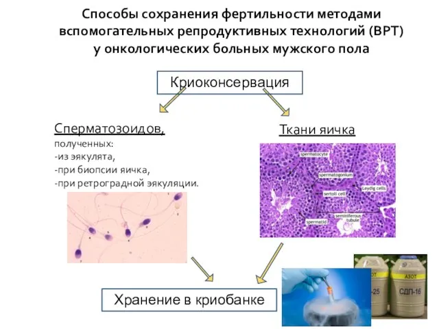 Способы сохранения фертильности методами вспомогательных репродуктивных технологий (ВРТ) у онкологических больных