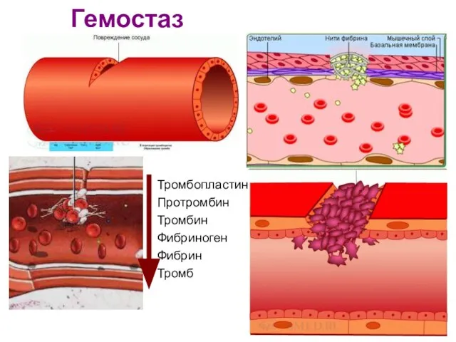 Гемостаз Тромбопластин Протромбин Тромбин Фибриноген Фибрин Тромб