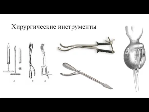 Хирургические инструменты