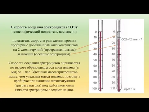 Скорость оседания эритроцитов (СОЭ): неспецифический показатель воспаления показатель скорости разделения крови