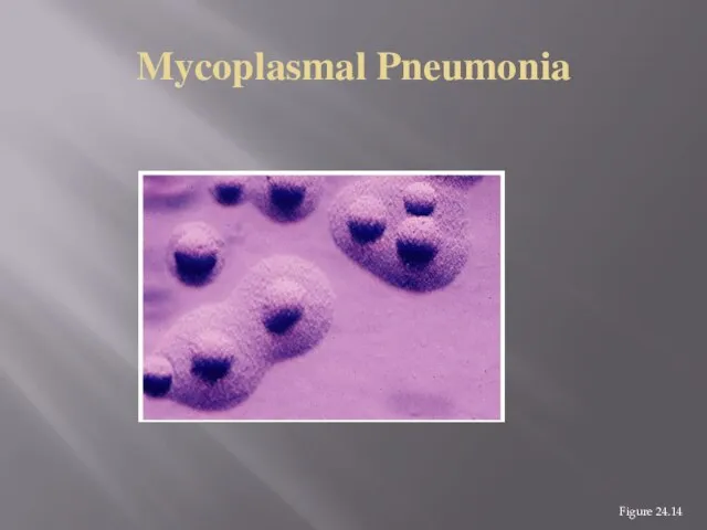 Mycoplasmal Pneumonia Figure 24.14