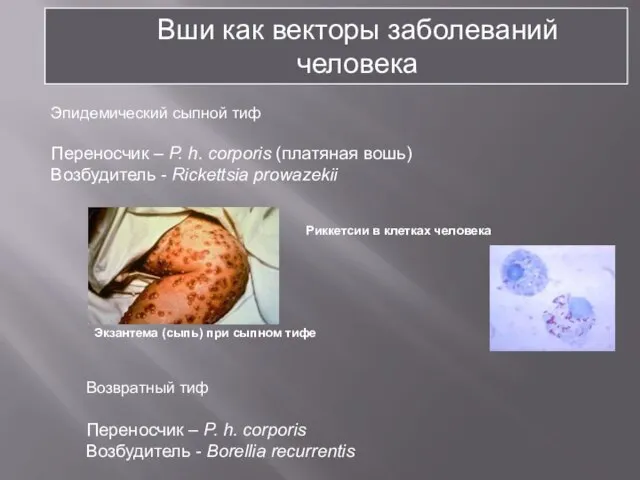 Вши как векторы заболеваний человека Эпидемический сыпной тиф Переносчик – P.