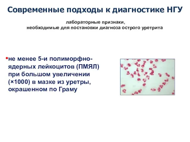 Современные подходы к диагностике НГУ не менее 5-и полиморфно-ядерных лейкоцитов (ПМЯЛ)