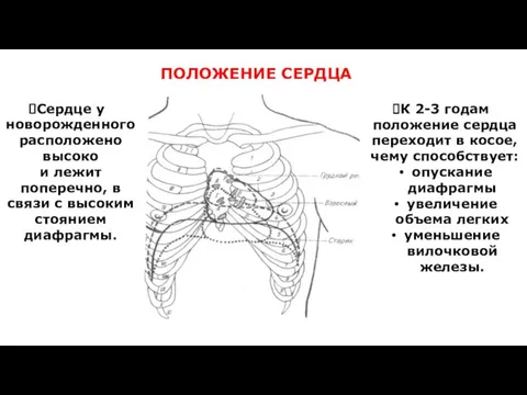 ПОЛОЖЕНИЕ СЕРДЦА Сердце у новорожденного расположено высоко и лежит поперечно, в