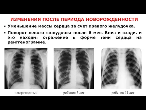 новорожденный ИЗМЕНЕНИЯ ПОСЛЕ ПЕРИОДА НОВОРОЖДЕННОСТИ ребенок 3 лет ребенок 11 лет