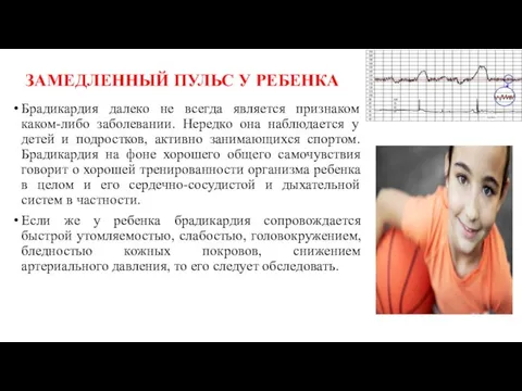 ЗАМЕДЛЕННЫЙ ПУЛЬС У РЕБЕНКА Брадикардия далеко не всегда является признаком каком-либо