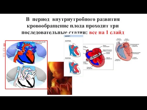 В период внутриутробного развития кровообращение плода проходит три последовательные стадии: все