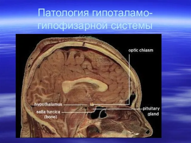 Патология гипоталамо-гипофизарной системы