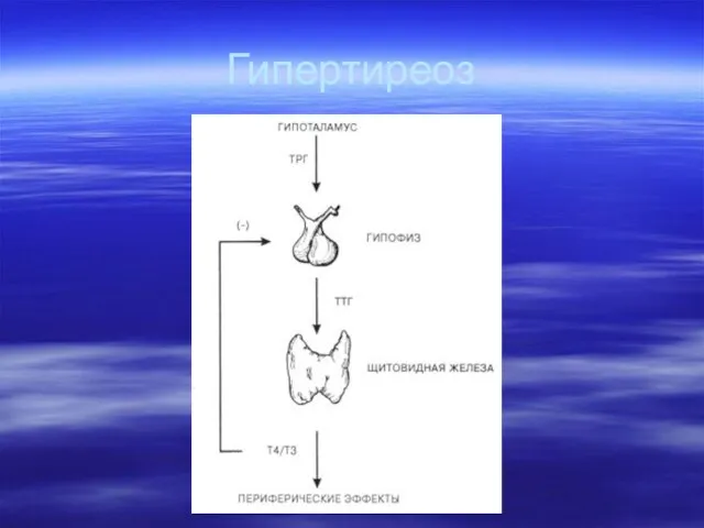 Гипертиреоз
