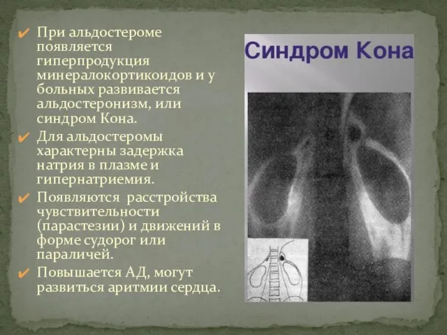 При альдостероме появляется гиперпродукция минералокортикоидов и у больных развивается альдостеронизм, или