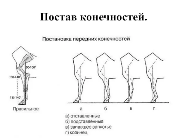 Постав конечностей.