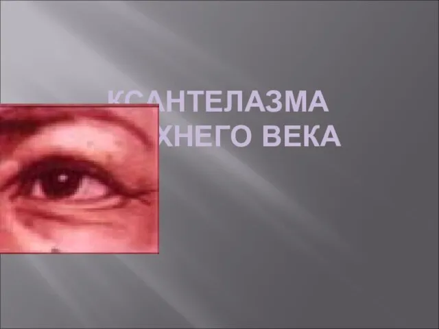 КСАНТЕЛАЗМА ВЕРХНЕГО ВЕКА