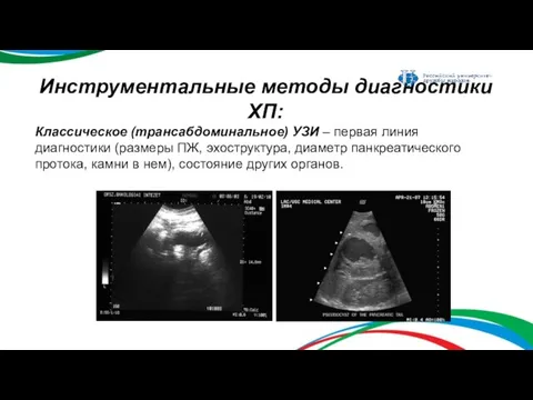 Инструментальные методы диагностики ХП: Классическое (трансабдоминальное) УЗИ – первая линия диагностики