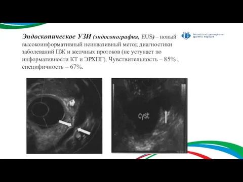 Эндоскопическое УЗИ (эндосонография, EUS) – новый высокоинформативный неинвазивный метод диагностики заболеваний