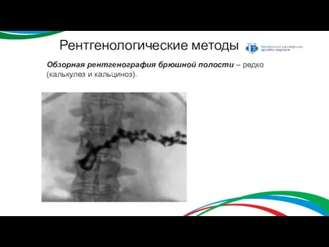 Рентгенологические методы Обзорная рентгенография брюшной полости – редко (калькулез и кальциноз).