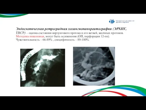 Эндоскопическая ретроградная холангиопанкреатография (ЭРХПГ, ERCP) – оценка состояния вирзунгового протока и