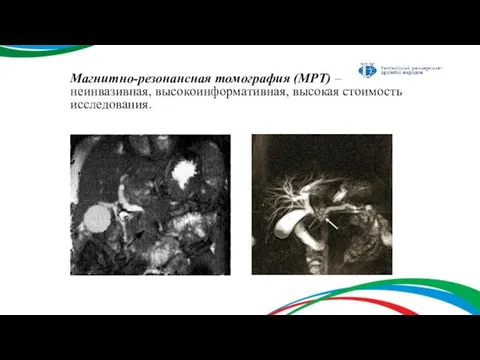 Магнитно-резонансная томография (МРТ) – неинвазивная, высокоинформативная, высокая стоимость исследования.