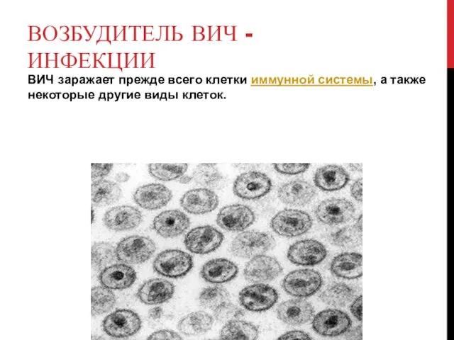 ВОЗБУДИТЕЛЬ ВИЧ - ИНФЕКЦИИ ВИЧ заражает прежде всего клетки иммунной системы,