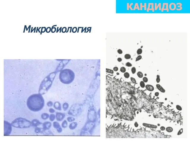 Микробиология КАНДИДОЗ