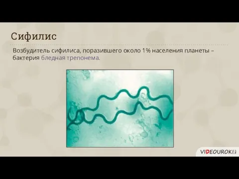 Сифилис Возбудитель сифилиса, поразившего около 1% населения планеты – бактерия бледная трепонема.