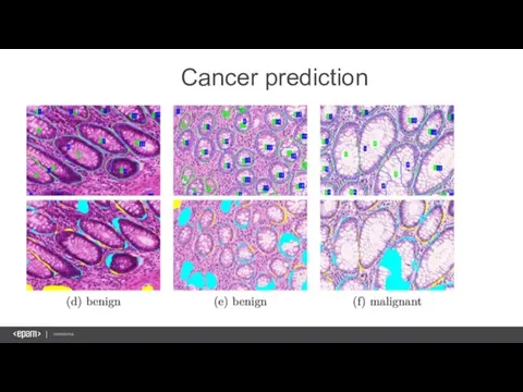 Cancer prediction