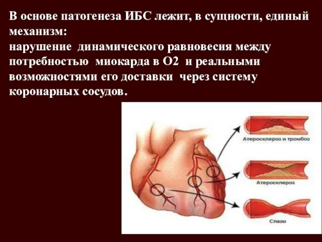 м+ В основе патогенеза ИБС лежит, в сущности, единый механизм: нарушение