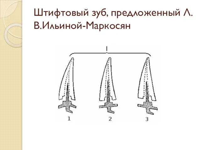 Штифтовый зуб, предложенный Л.В.Ильиной-Маркосян