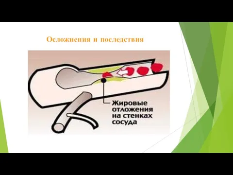 Осложнения и последствия