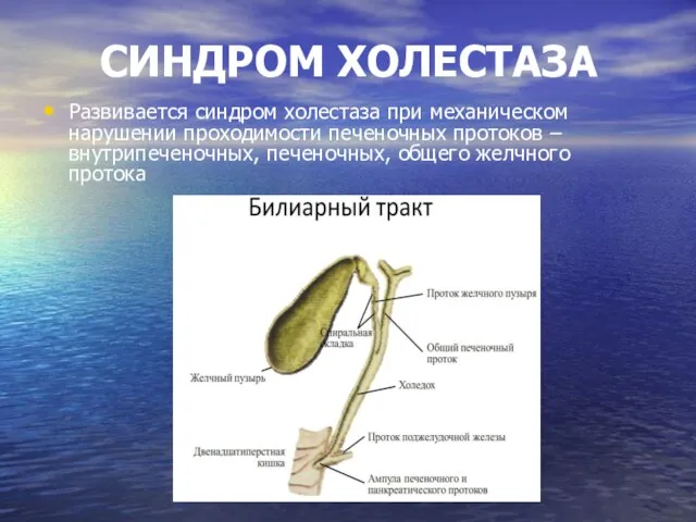 СИНДРОМ ХОЛЕСТАЗА Развивается синдром холестаза при механическом нарушении проходимости печеночных протоков