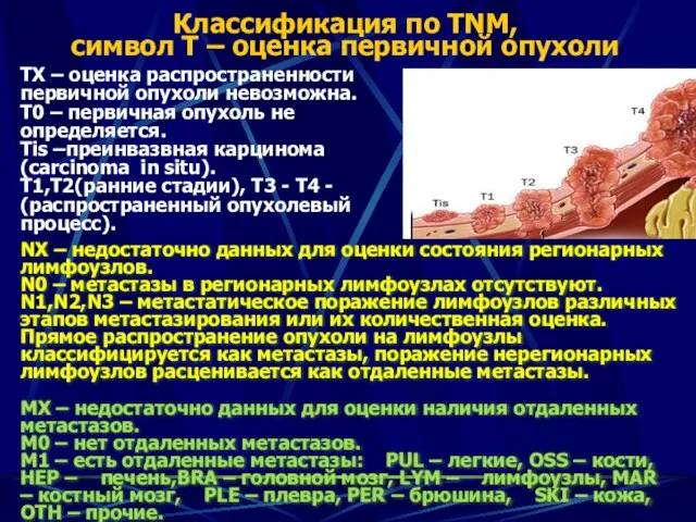 Классификация по TNM, символ Т – оценка первичной опухоли ТХ –