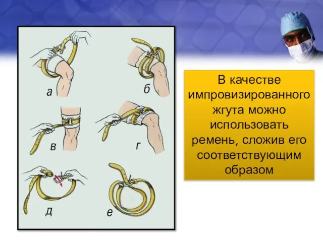 В качестве импровизированного жгута можно использовать ремень, сложив его соответствующим образом