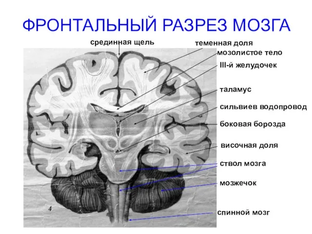 ФРОНТАЛЬНЫЙ РАЗРЕЗ МОЗГА срединная щель теменная доля мозолистое тело III-й желудочек