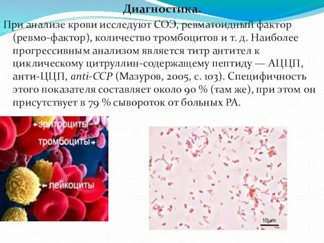 Диагностика. При анализе крови исследуют СОЭ, ревматоидный фактор (ревмо-фактор), количество тромбоцитов