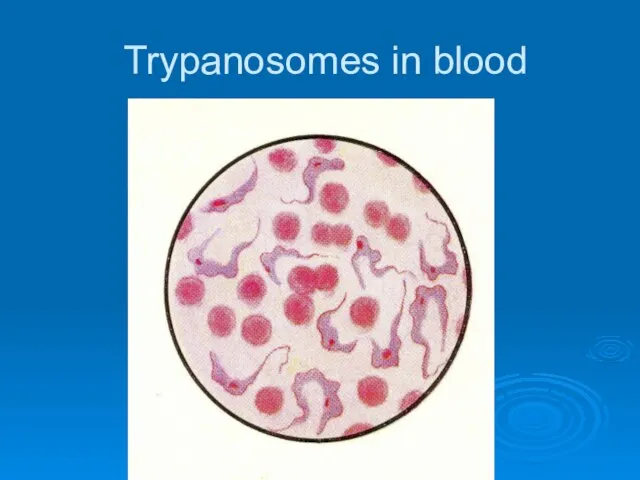 Trypanosomes in blood