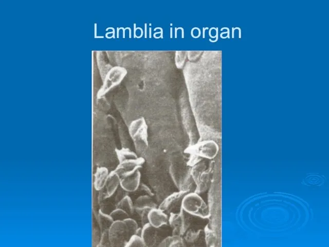 Lamblia in organ