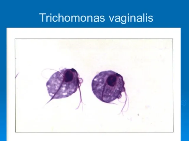 Trichomonas vaginalis