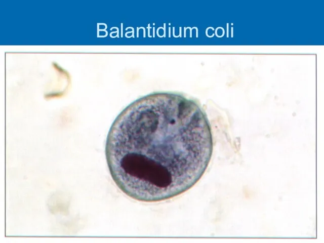 Balantidium coli