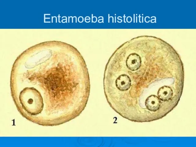 Entamoeba histolitica