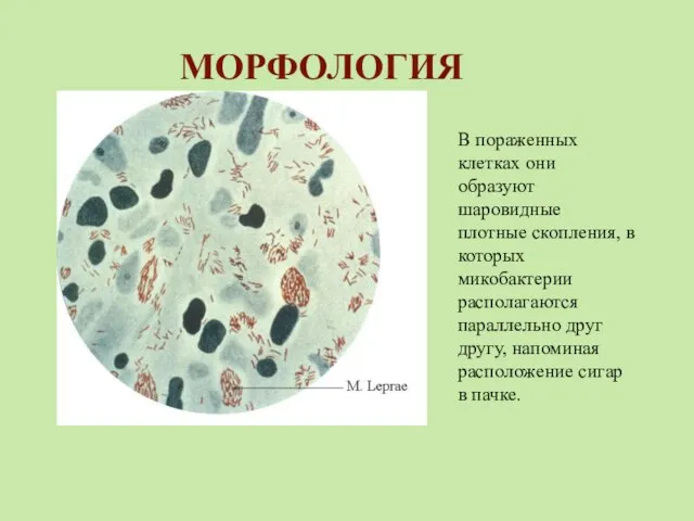 МОРФОЛОГИЯ В пораженных клетках они образуют шаровидные плотные скопления, в которых