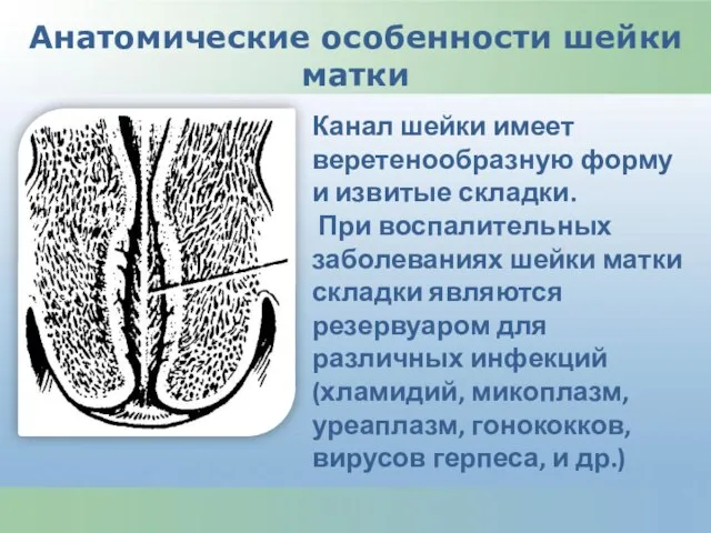 Канал шейки имеет веретенообразную форму и извитые складки. При воспалительных заболеваниях