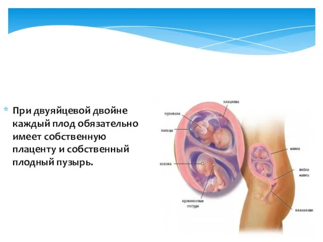 При двуяйцевой двойне каждый плод обязательно имеет собственную плаценту и собственный плодный пузырь.