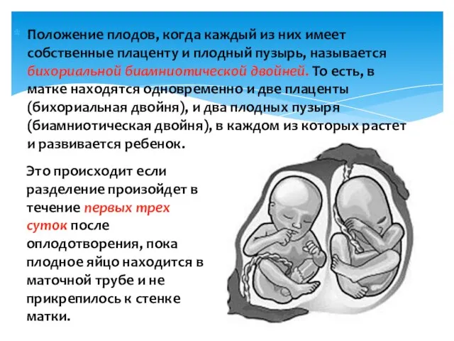 Положение плодов, когда каждый из них имеет собственные плаценту и плодный