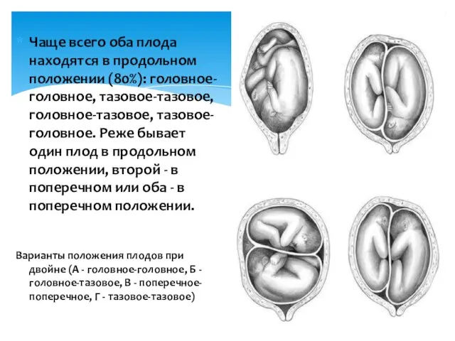 Чаще всего оба плода находятся в продольном положении (80%): головное-головное, тазовое-тазовое,