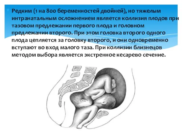 Редким (1 на 800 беременностей двойней), но тяжелым интранатальным осложнением является